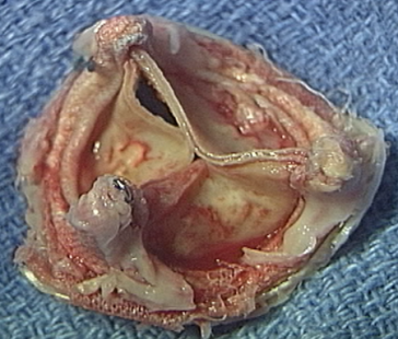 AKE bio entzündlich degenerativ