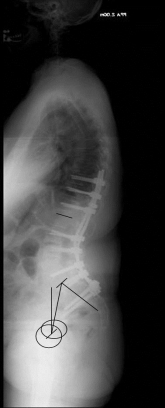 Adulte Def. II Adulte Def. II